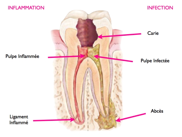 Endodontie